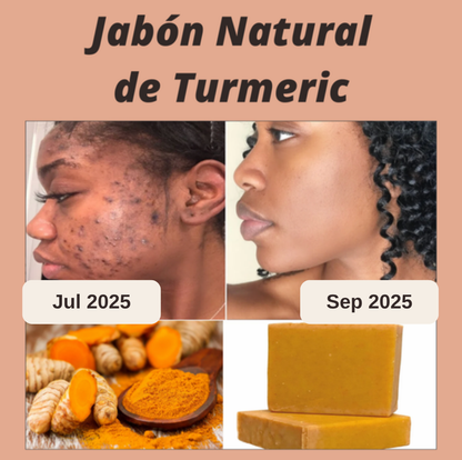 Pack x3 Jabón Aclarador con Cúrcuma y Ácido Kójico